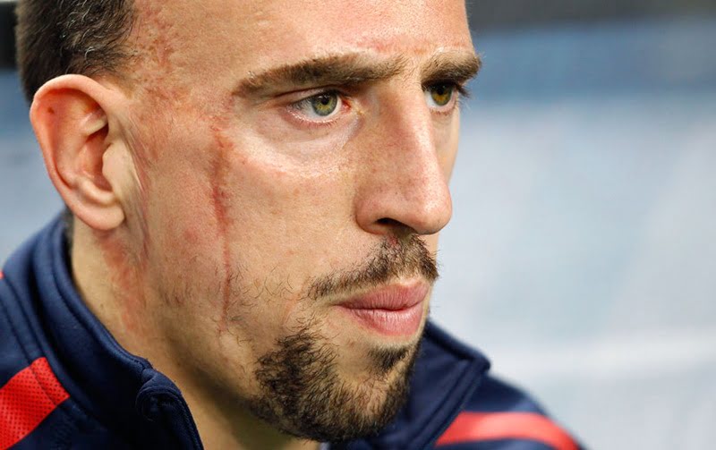 ribery